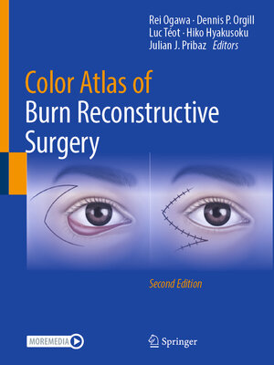 cover image of Color Atlas of Burn Reconstructive Surgery